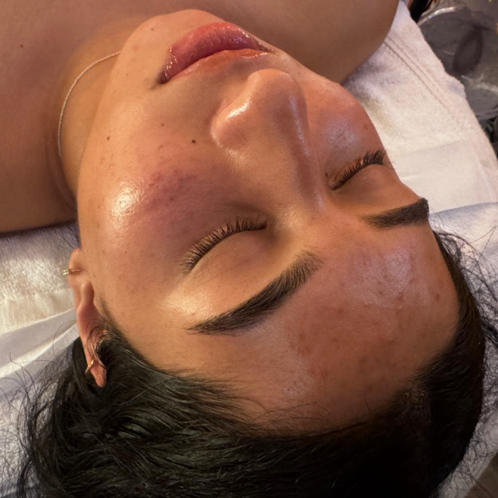 New Client Virtual Consultation at Alora Skin in Sacramento, CA