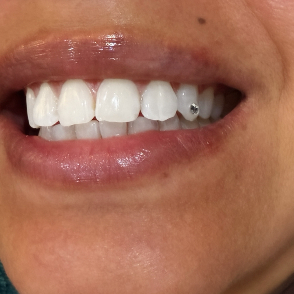 Tooth Gem at Naomi  Pena in Puyallup, WA