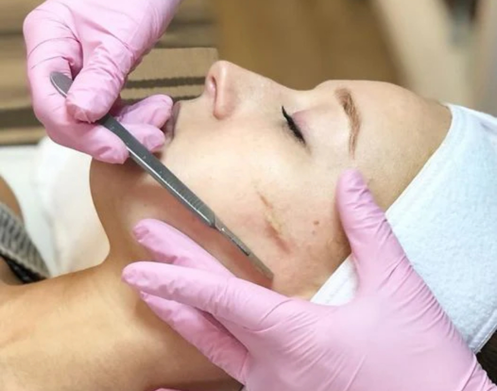 Dermaplaning Facial