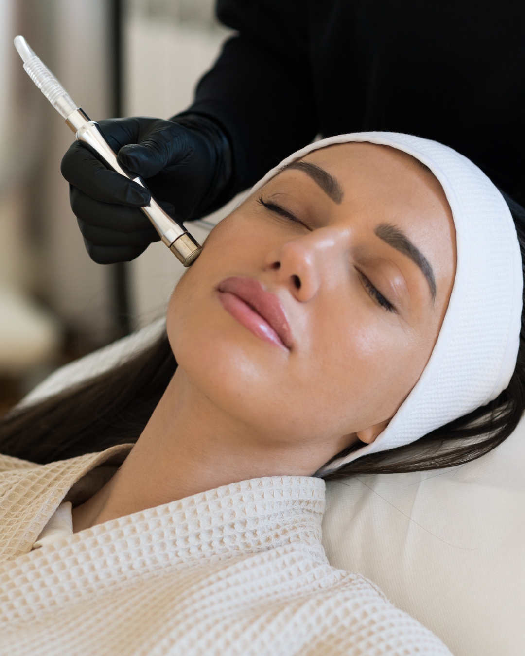 Microdermabrasion (add on)