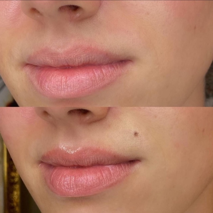 Beauty Marks at Aesthetic Brow Studio in Winter Haven, FL