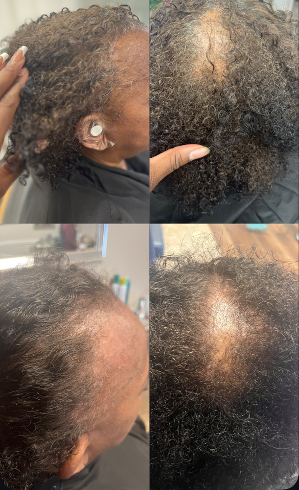 Hair Growth/Rejuvenation Treatment
