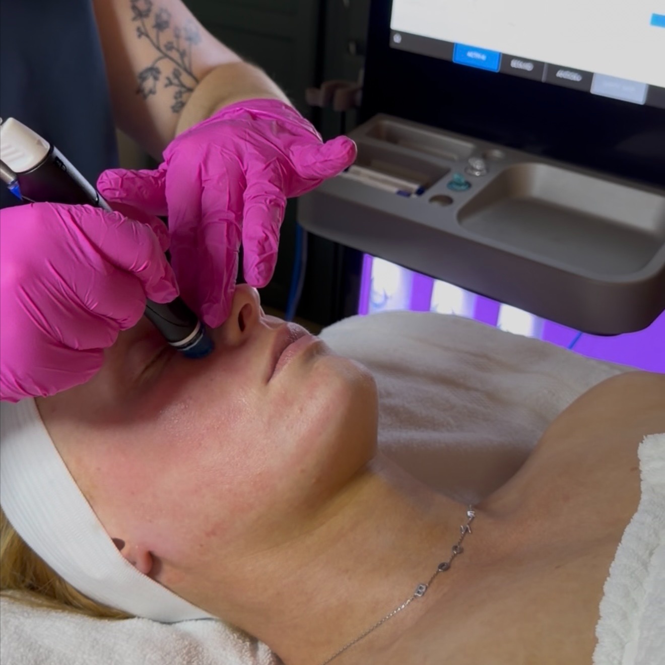 Hydrafacial at Luxe Lineage Esthetics in Christiansburg, VA