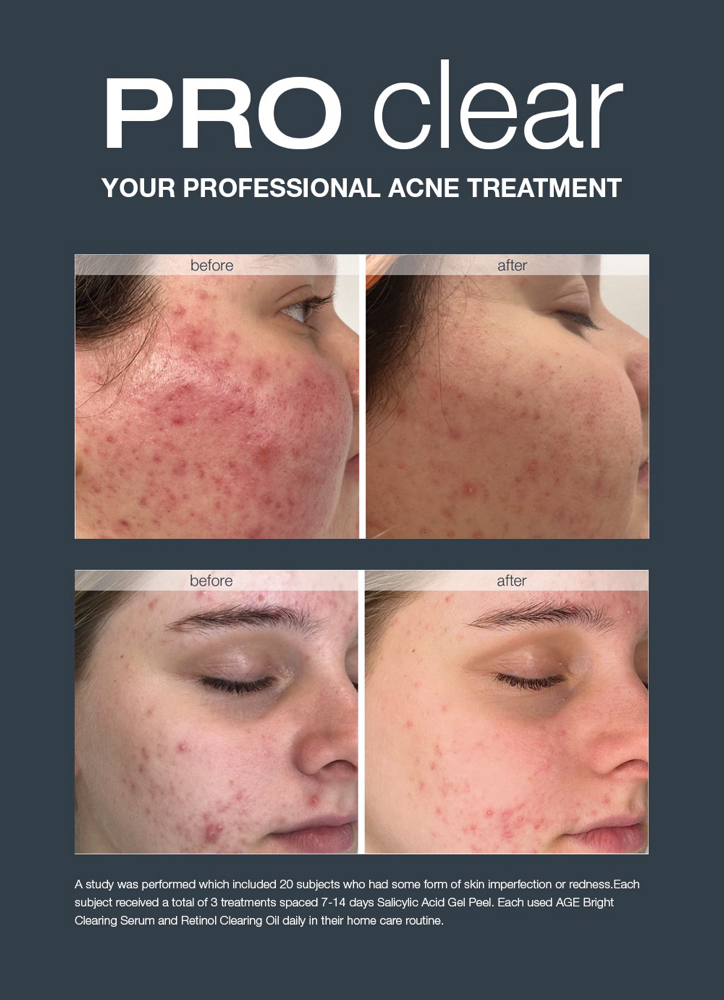 Pro Clear Facial