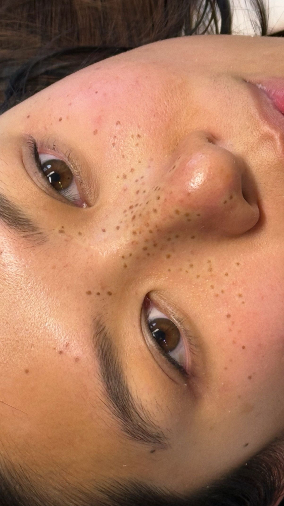 Freckle Tattoos