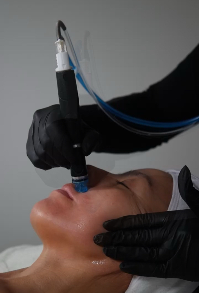 NEW CLIENT Hydrafacial Special