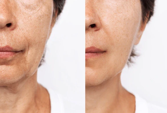 Anti Aging Facial