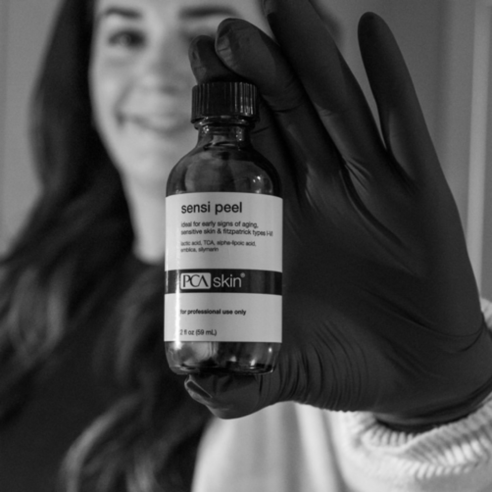 Custom PCA Peel Facial