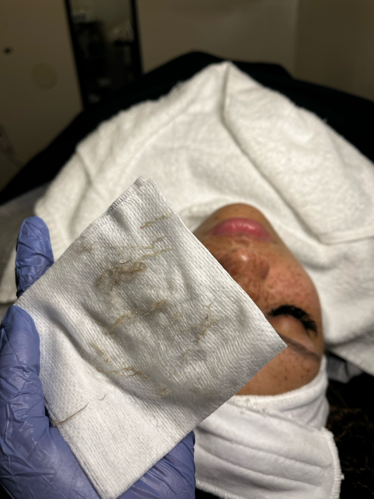 Dermaplane at Beauty Blvd in Columbus, OH