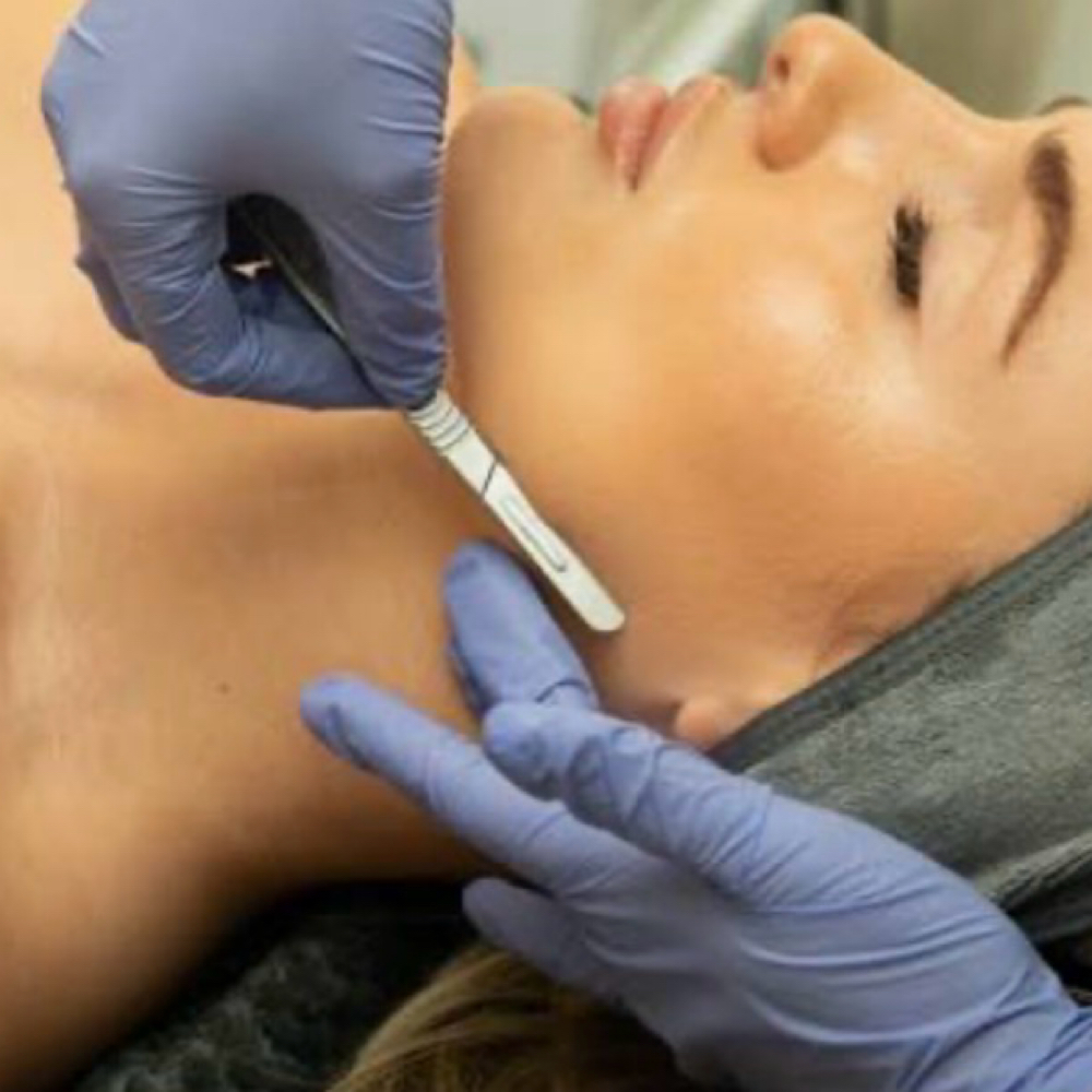 ADD-ON DERMAPLANE at Esthetics By Terry in Ofallon, MO