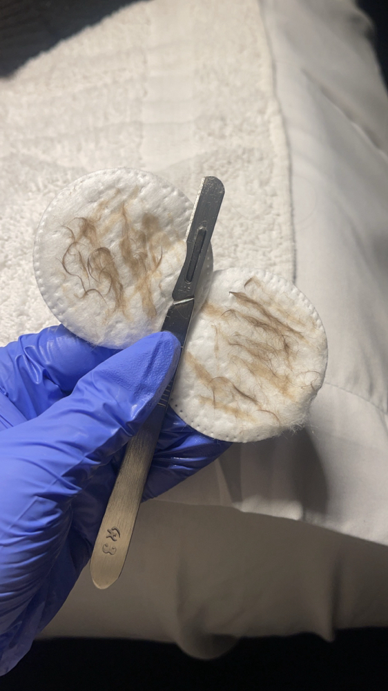 Dermaplane Facial