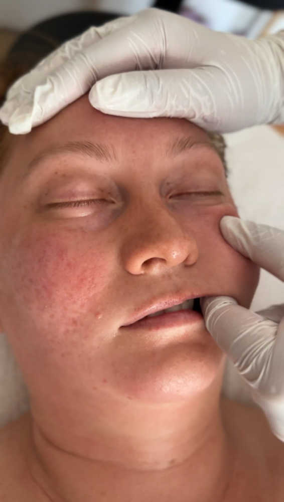 Buccal Massage Signature Facial