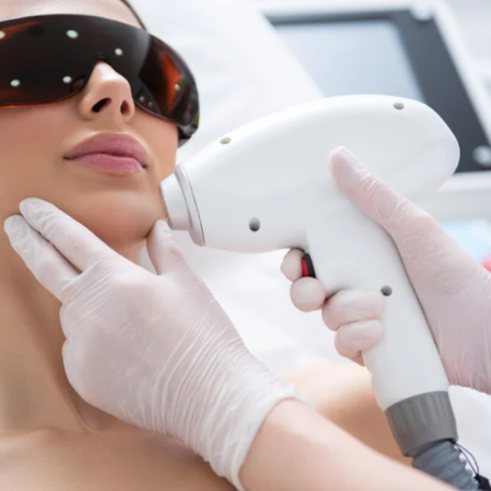 full face LASER HAIR REMOVAL at BEAUTY LAB COLLECTIVE in Miami, FL