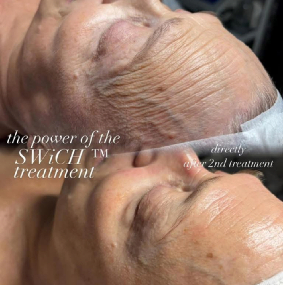 Circadia’s Swich Facial Treatment at Studio Lux Beauty Bar    Esthetics by Delanie & Lindsey in Mineola, TX