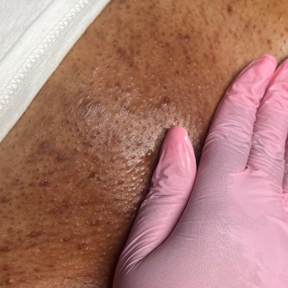 Brazilian+ at Kandi Esthetics in Meriden, CT