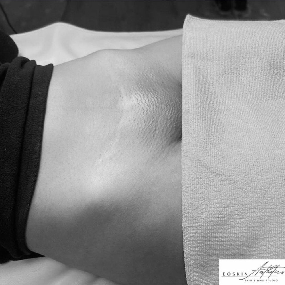 First Time Client Brazilian Wax at EO SKIN Aesthetics in Belfast, ME
