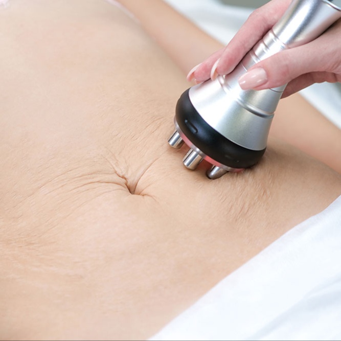 RF Skin-Tightening w/ Wood Therapy at CV Serenity Medspa in Mountainside, NJ