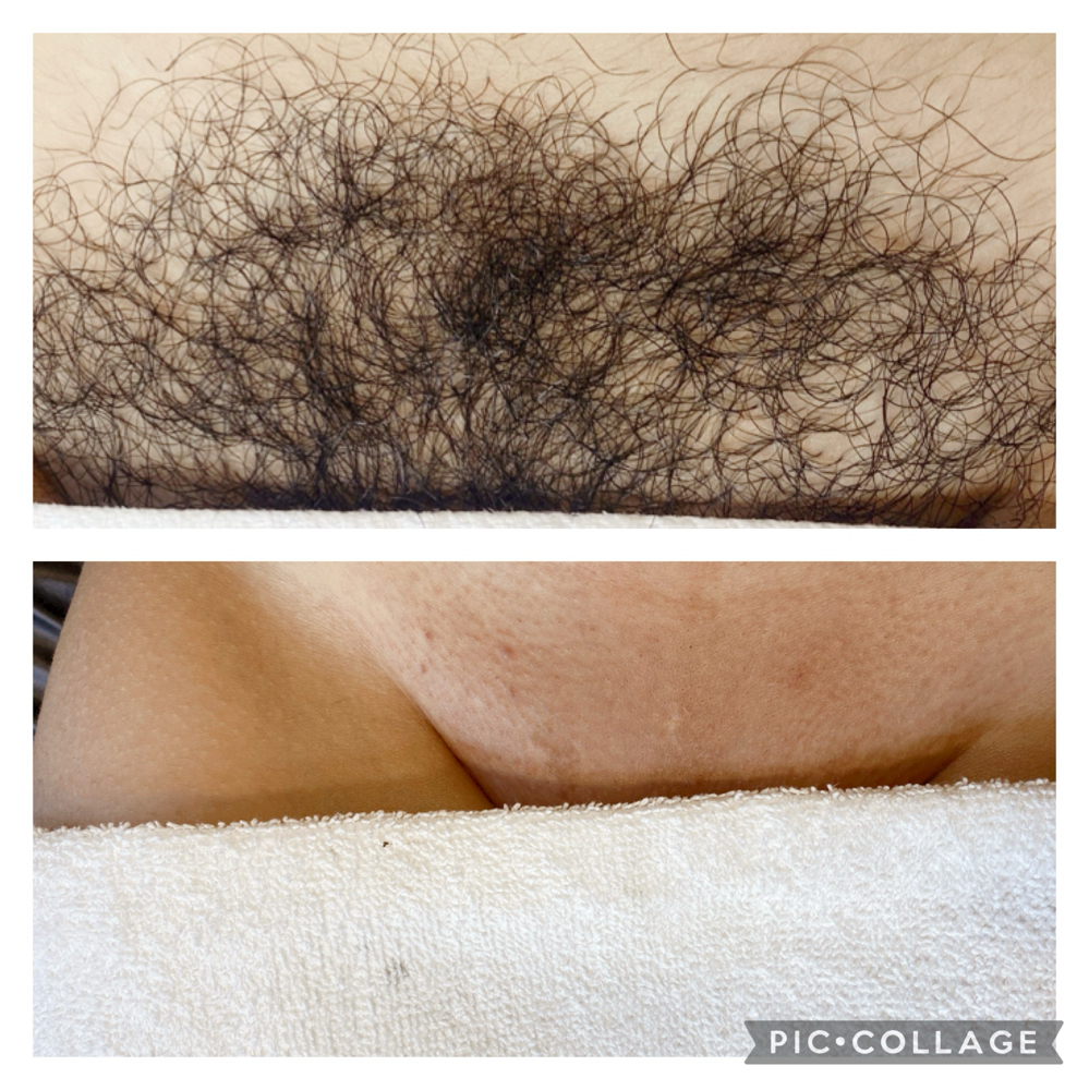 Brazilian Wax Training