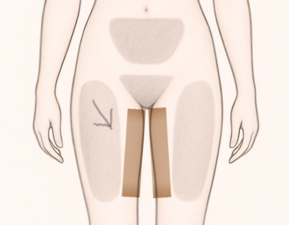 Inner Thigh