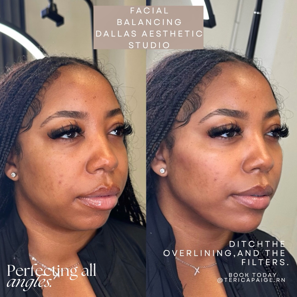 Facial Balancing at Dallas Aesthetic Studio in Dallas, TX