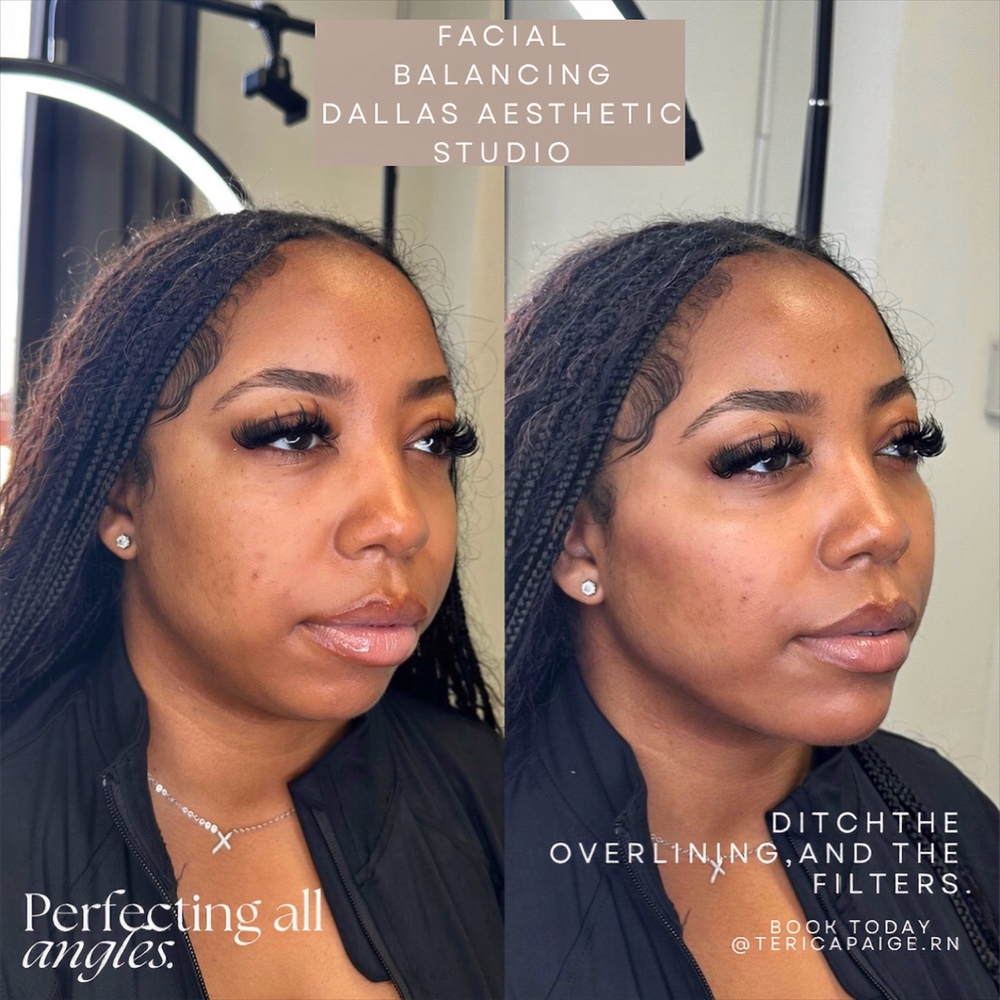Facial Balancing at Dallas Aesthetic Studio in Dallas, TX
