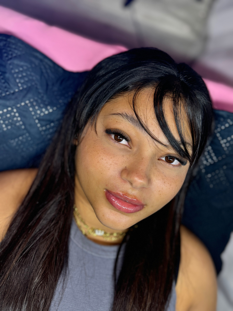 Aumento De Labios 1ML