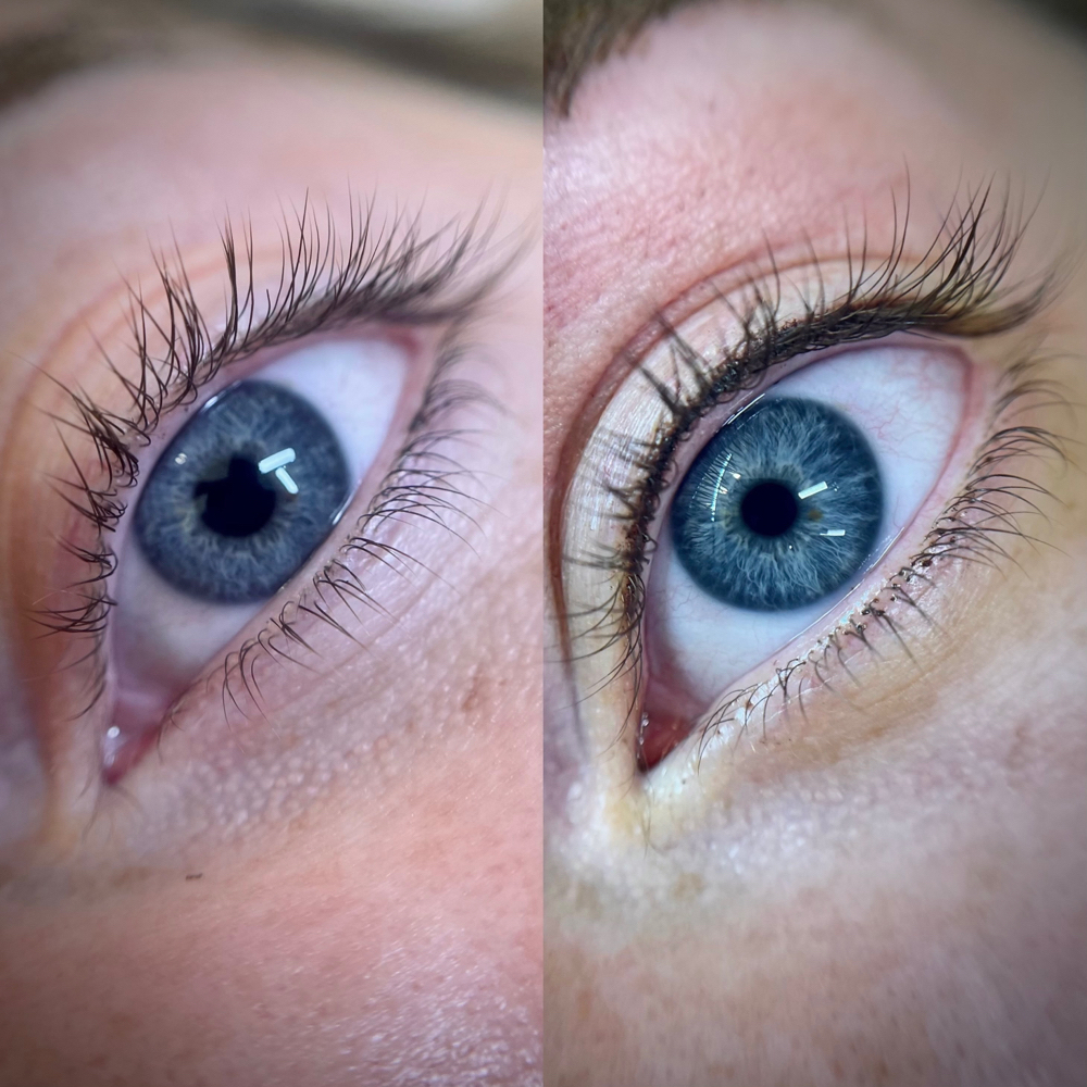 Lash Enhancement