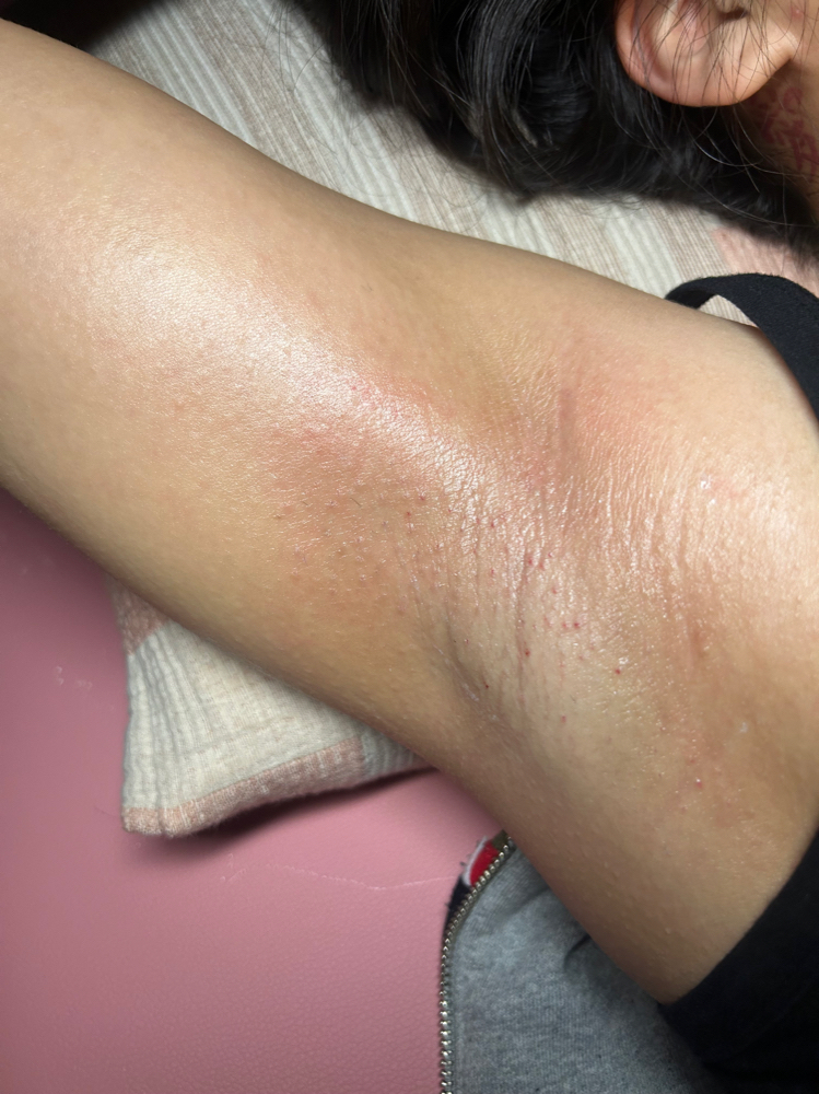Underarm Wax