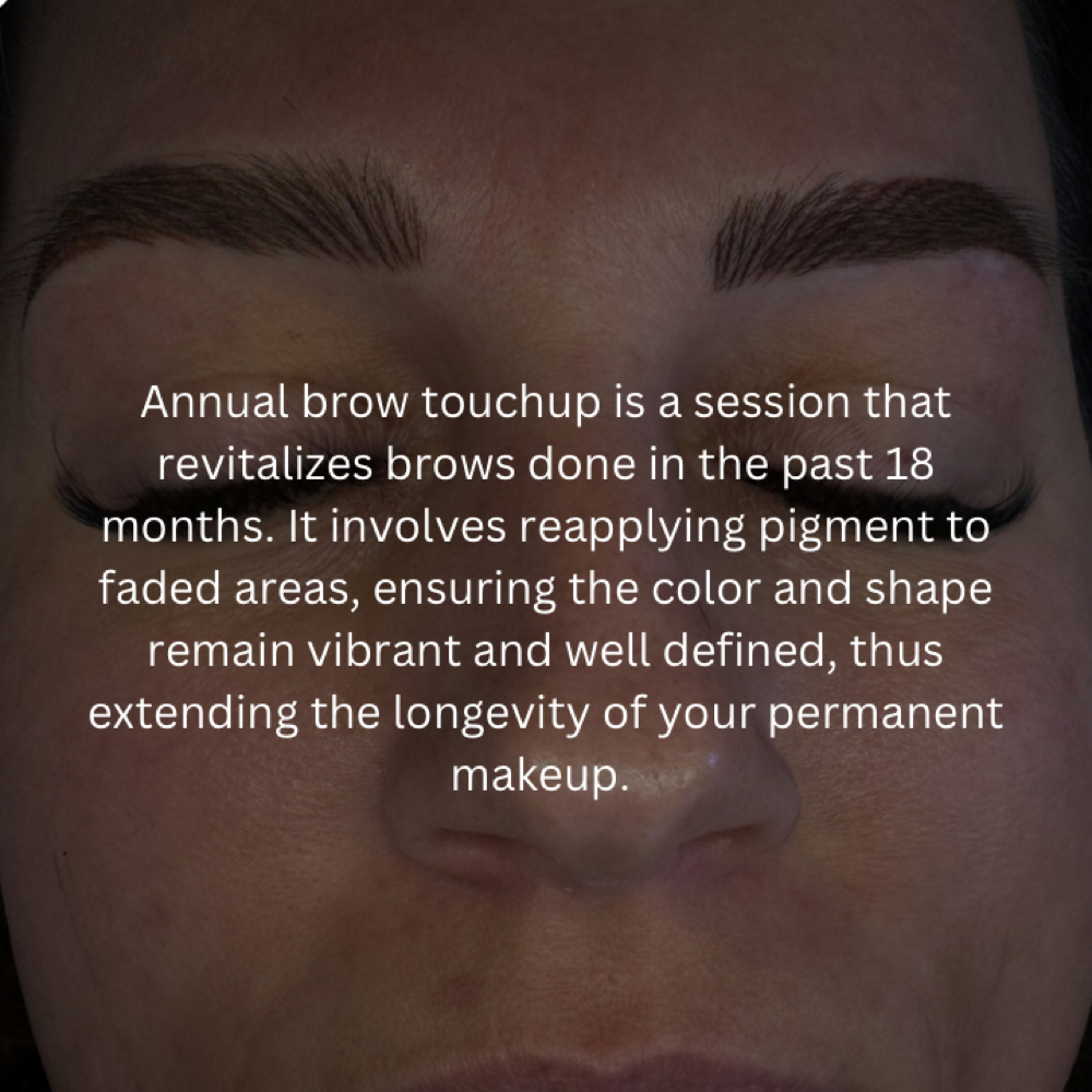 Annual Touchup at Assure Esthetics by Alisha in York, NE