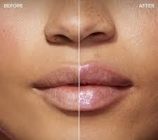 Mini Lip