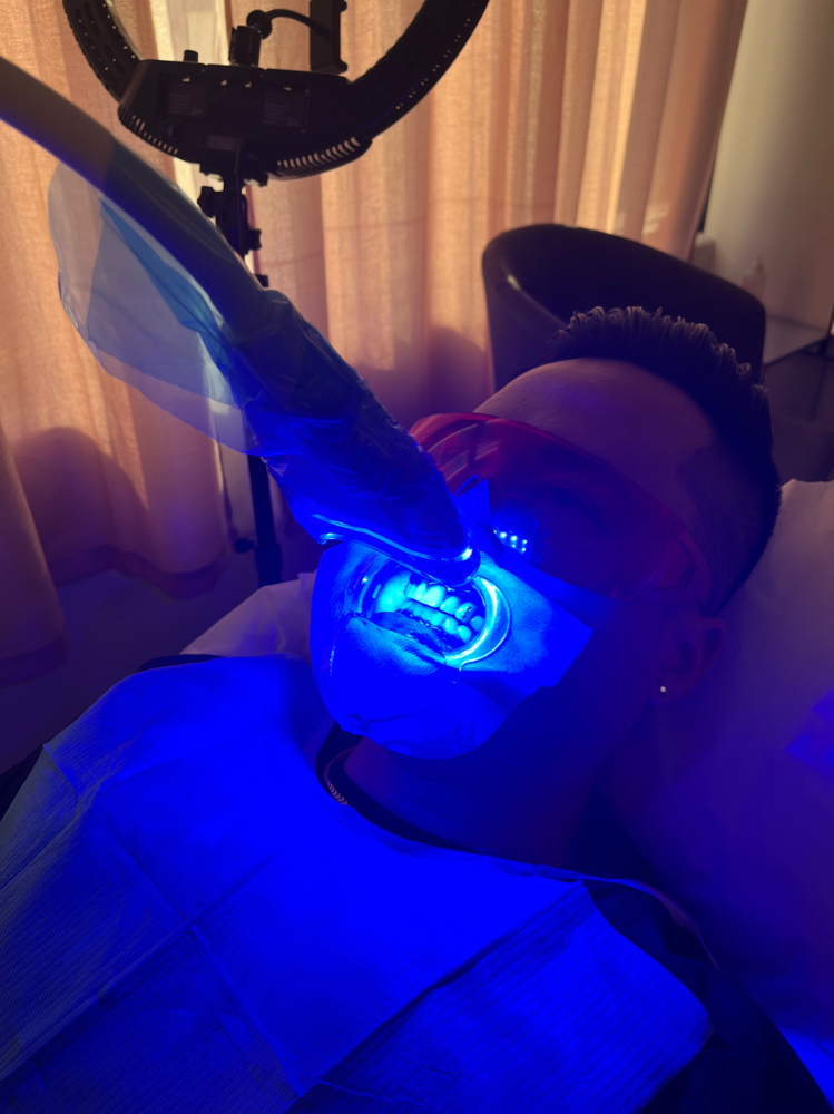 Teeth Whitening (Las Vegas)