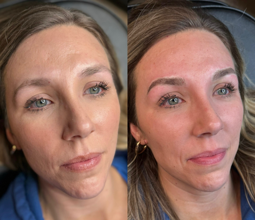 Permanent Brows