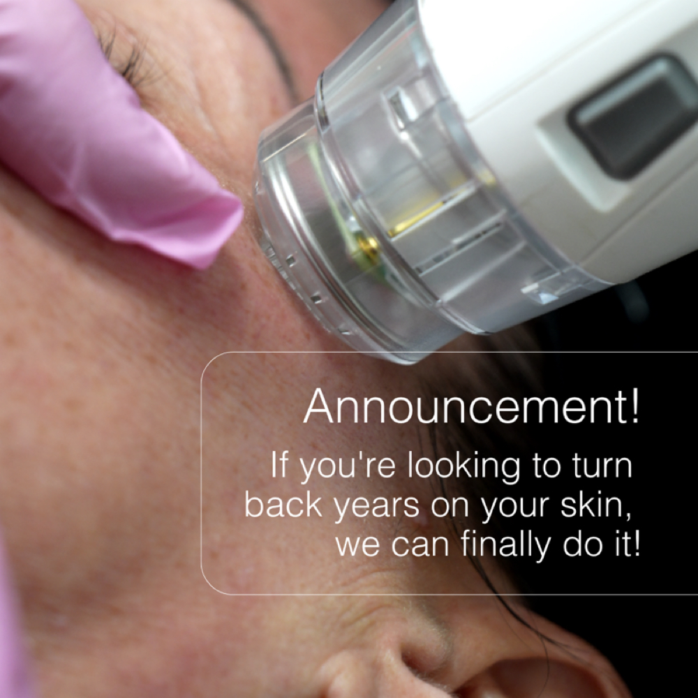 Matrix Sublative RF at Maven Luxe MedSpa in Houston, TX