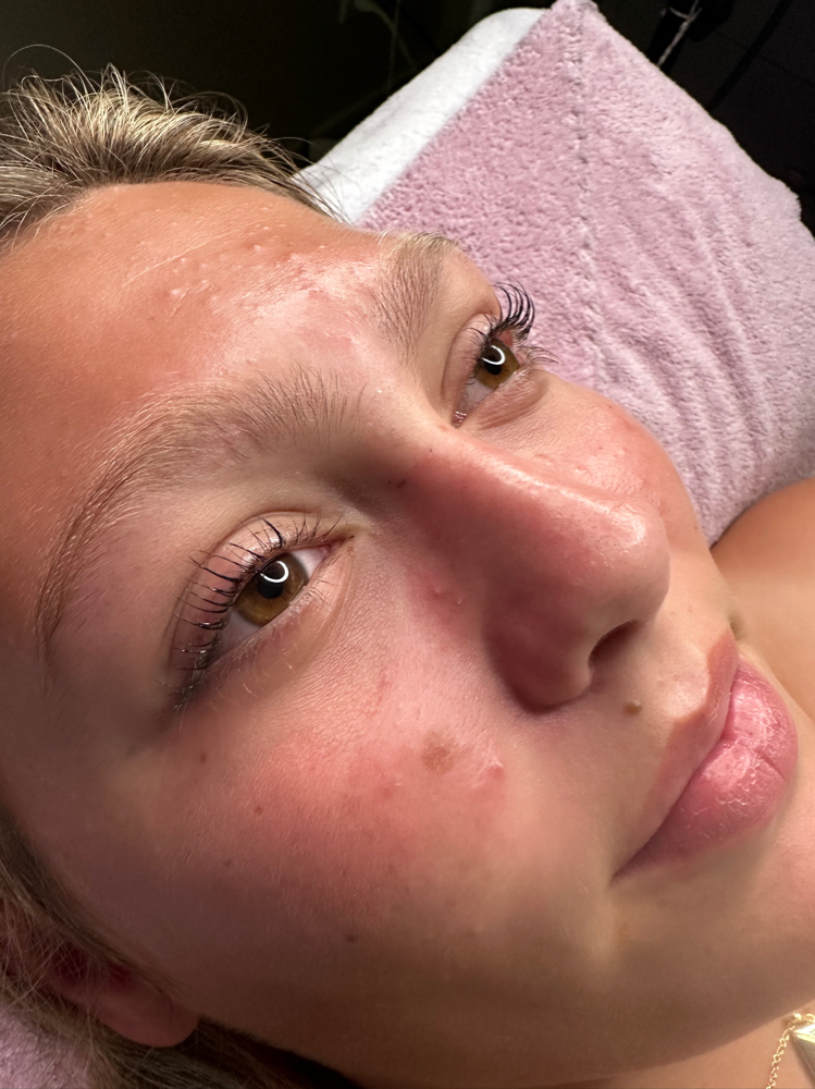 Lash Lift
