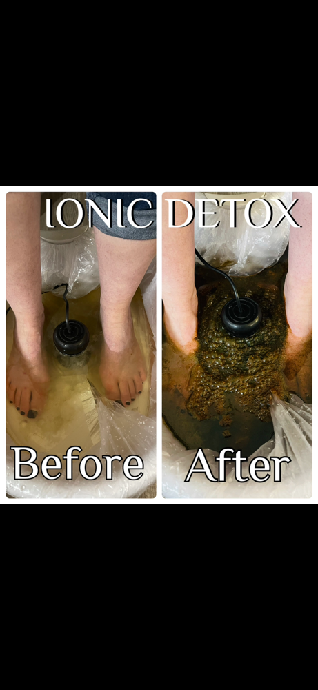 5 Sessions Ionic Derox