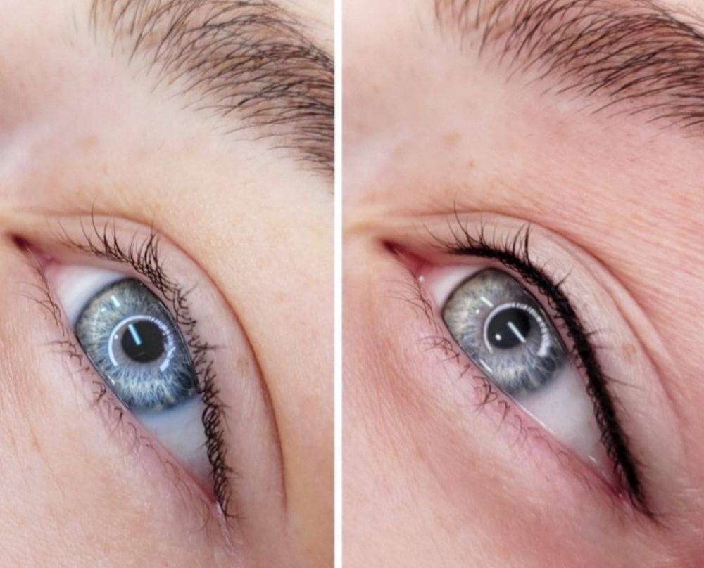 PMU Lash-line enhancement