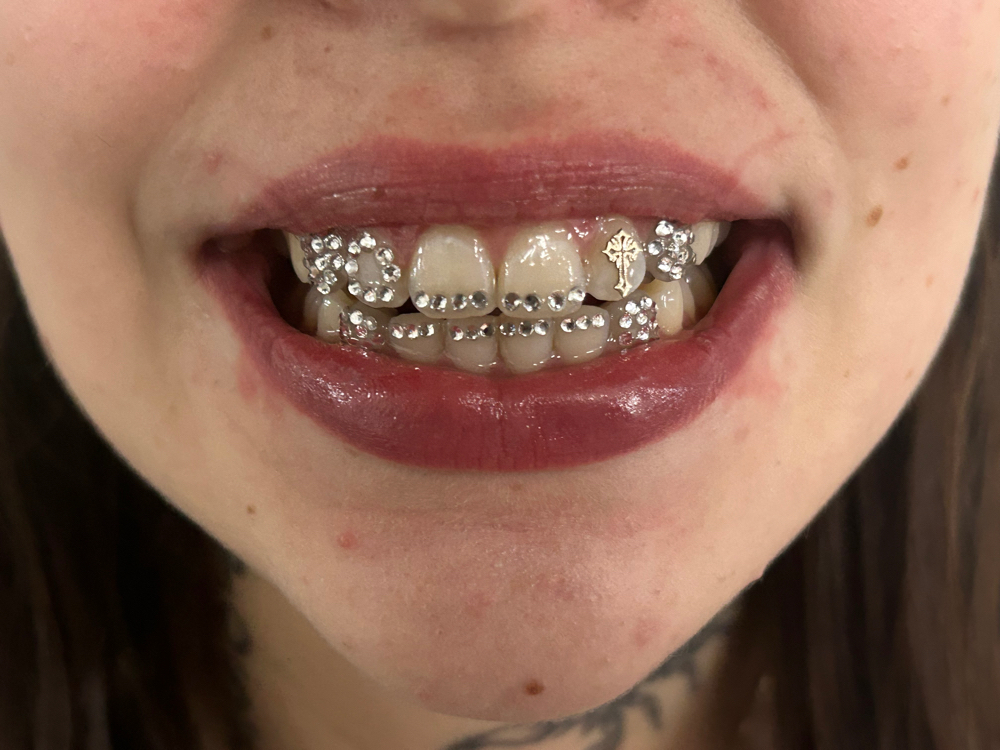 Custom #2
