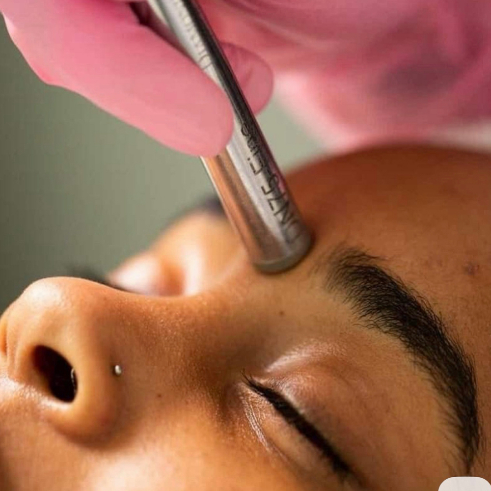Microdermabrasion at Glam Esthetics Spa in Tampa, FL