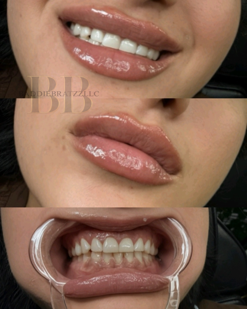 Teeth Whitening- 60 Minutes