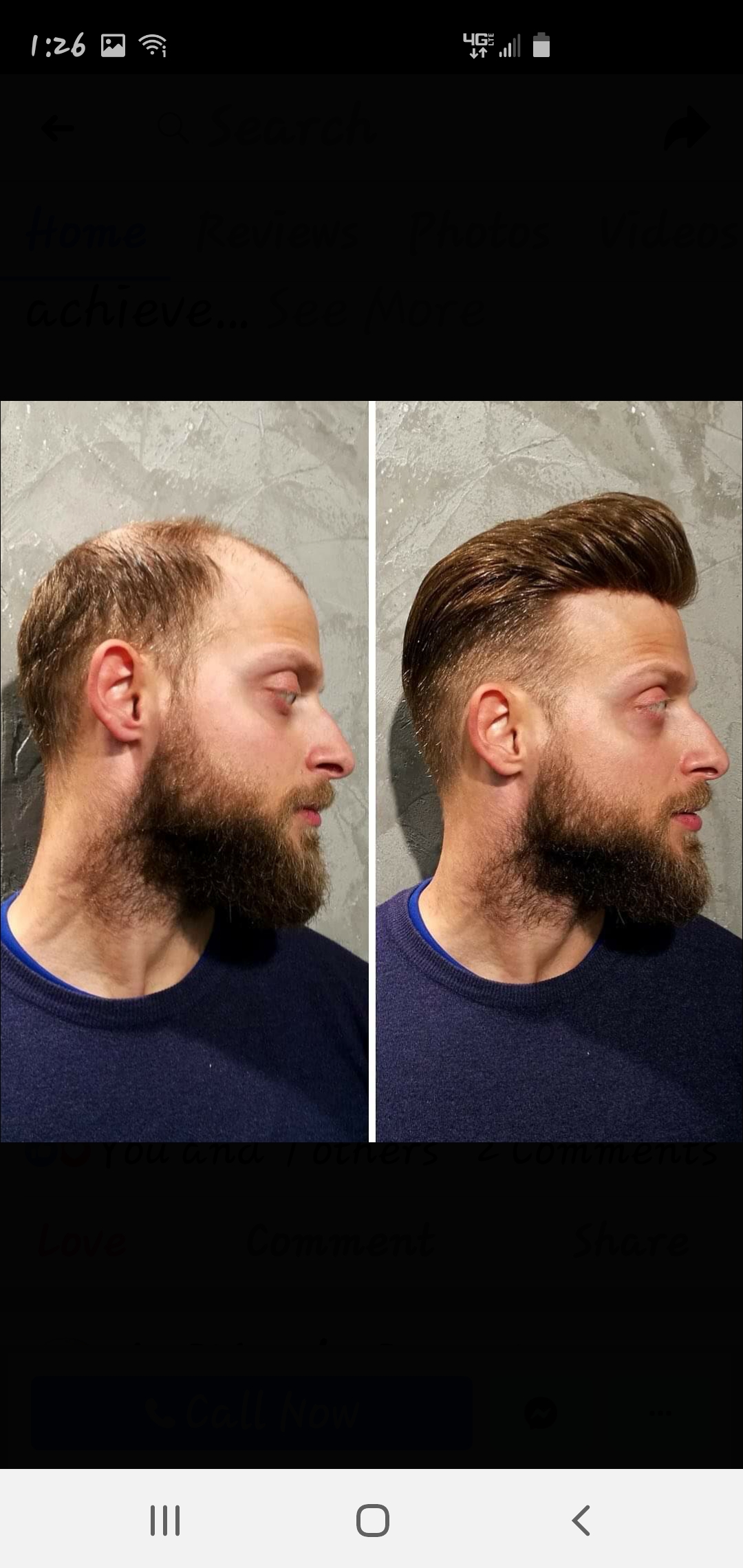 Hair replacement bonding
