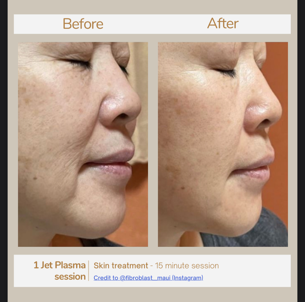 NEW Jet Glow Facial Treatment