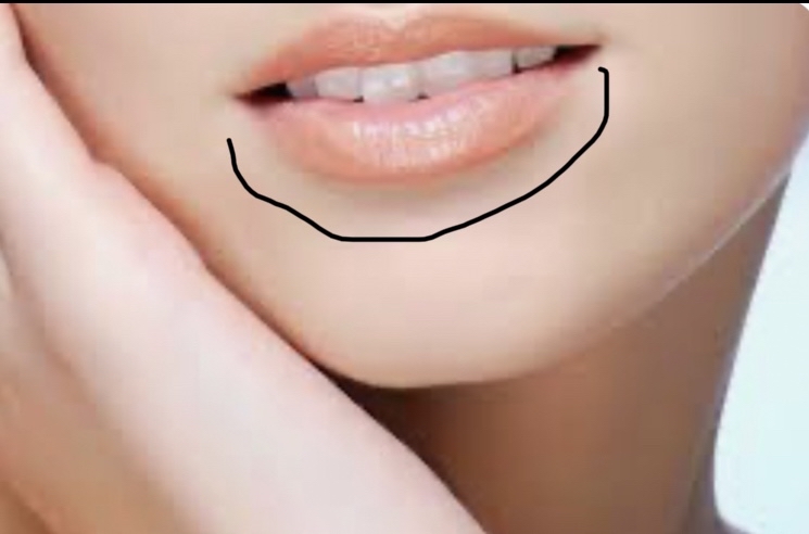 Lower Lip (ad on)