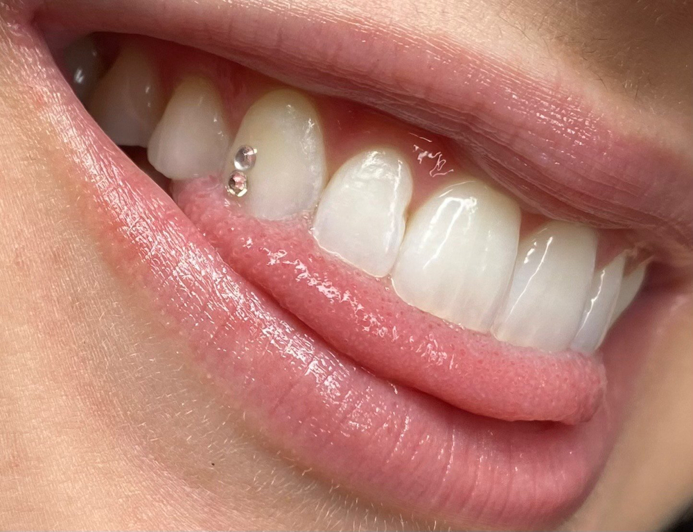 Tooth Gem