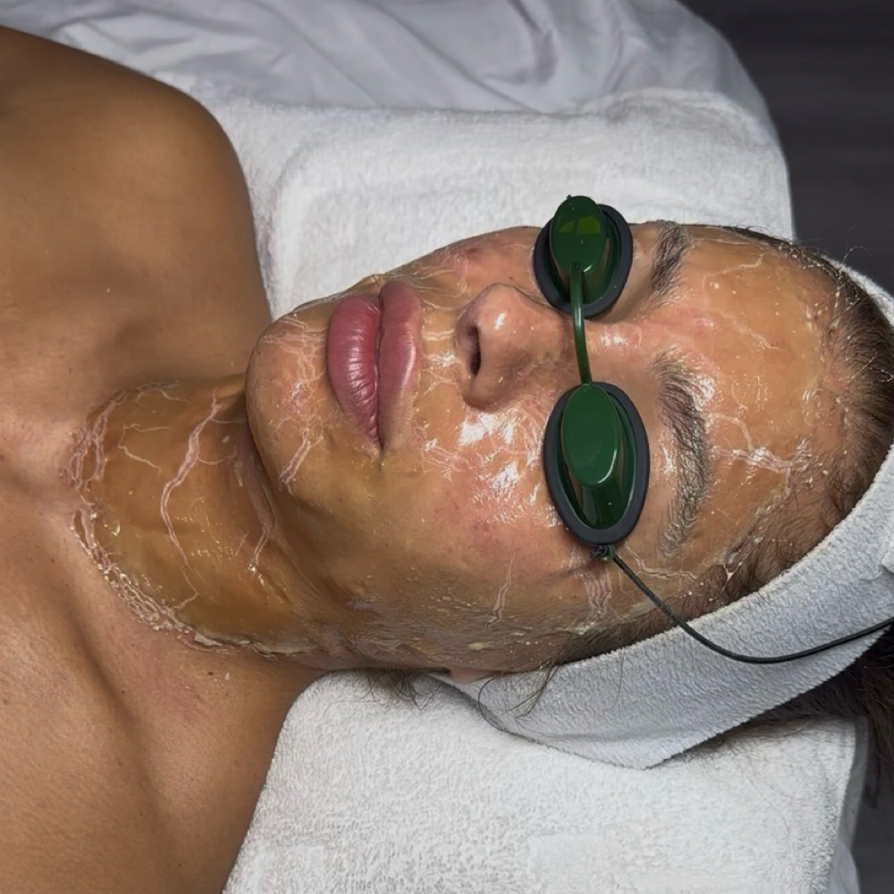 Firming Peptide Facial at Yirah Beauty in Houston, TX