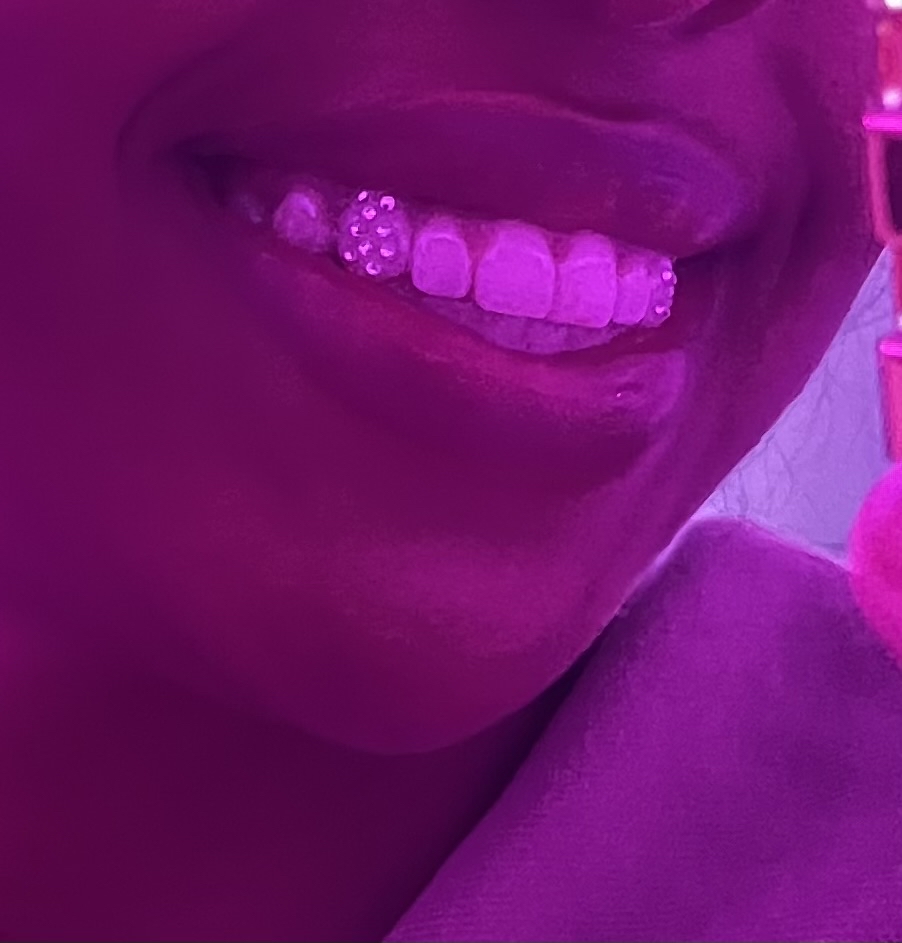 ‘Cosmic’ Tooth Gem Set