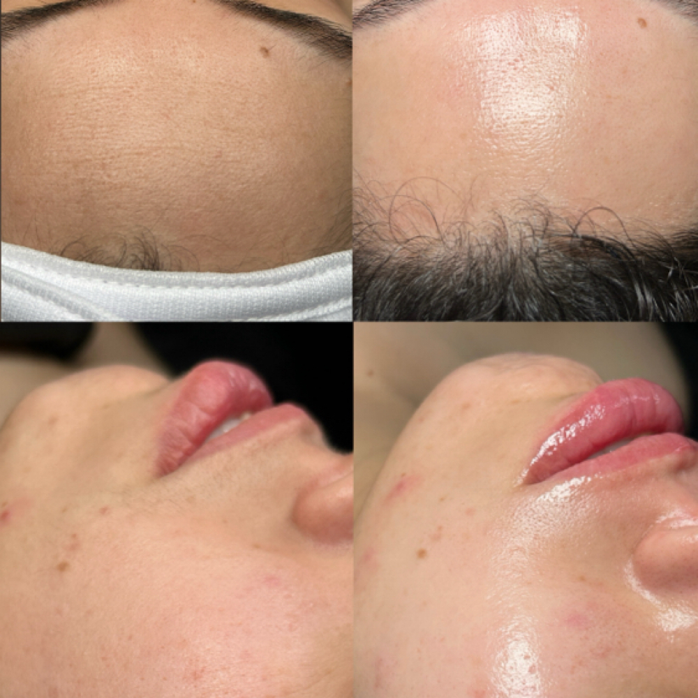 Derma Delight Facial at BBS Brow & Skin Studio✨ in Navasota, TX