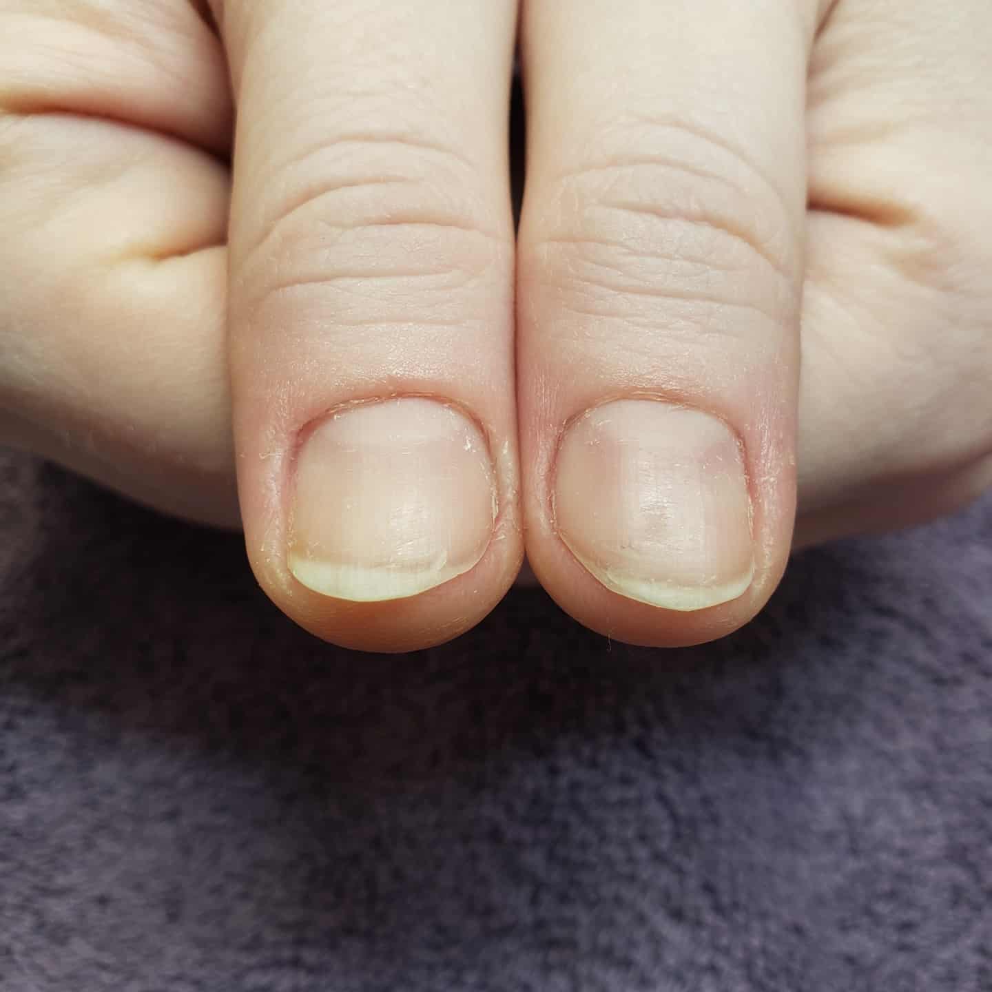 Nail Tip Fix at Rebellious Nails in Seattle, WA