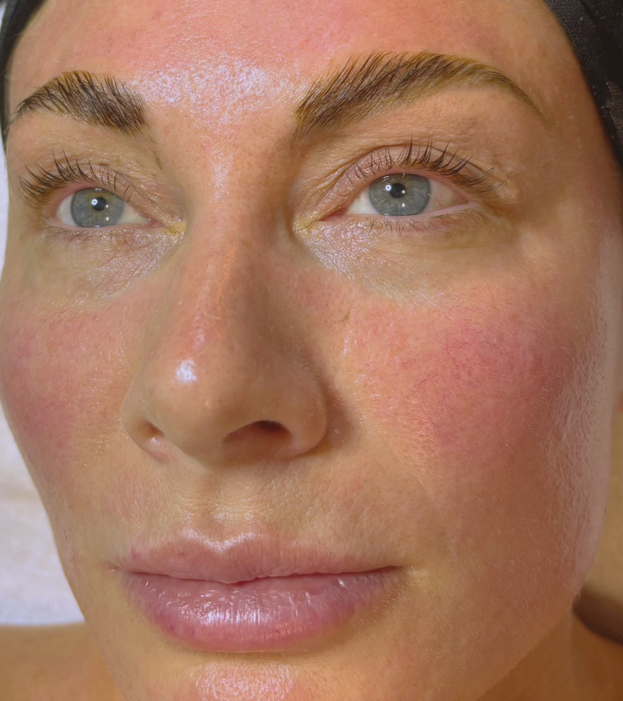 New Client Facial $79