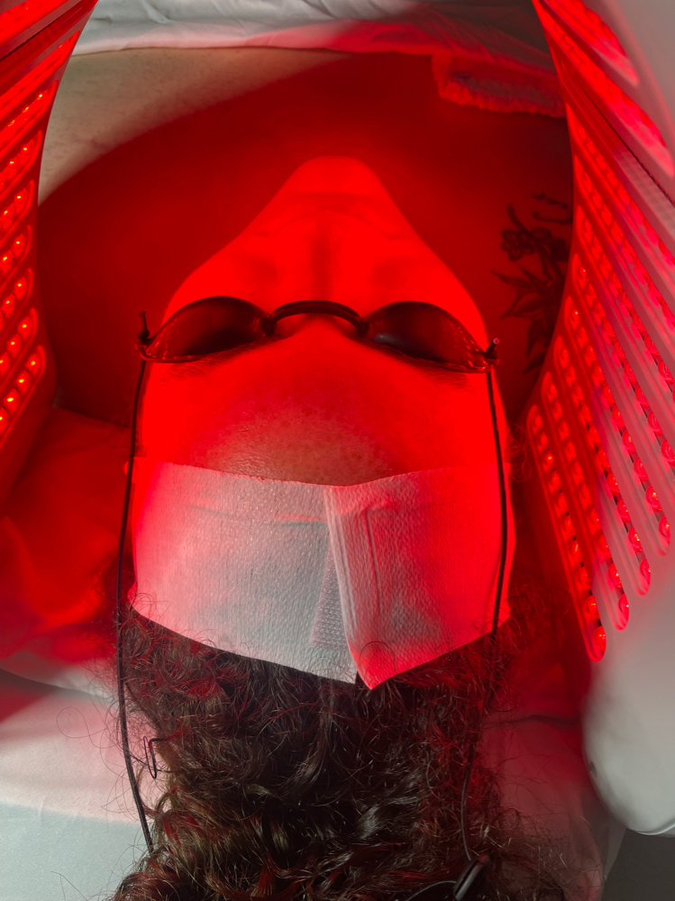 (Light Therapy) - Add On