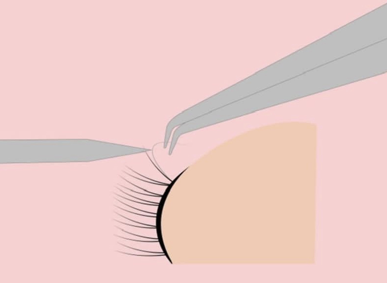 Lash Removal
